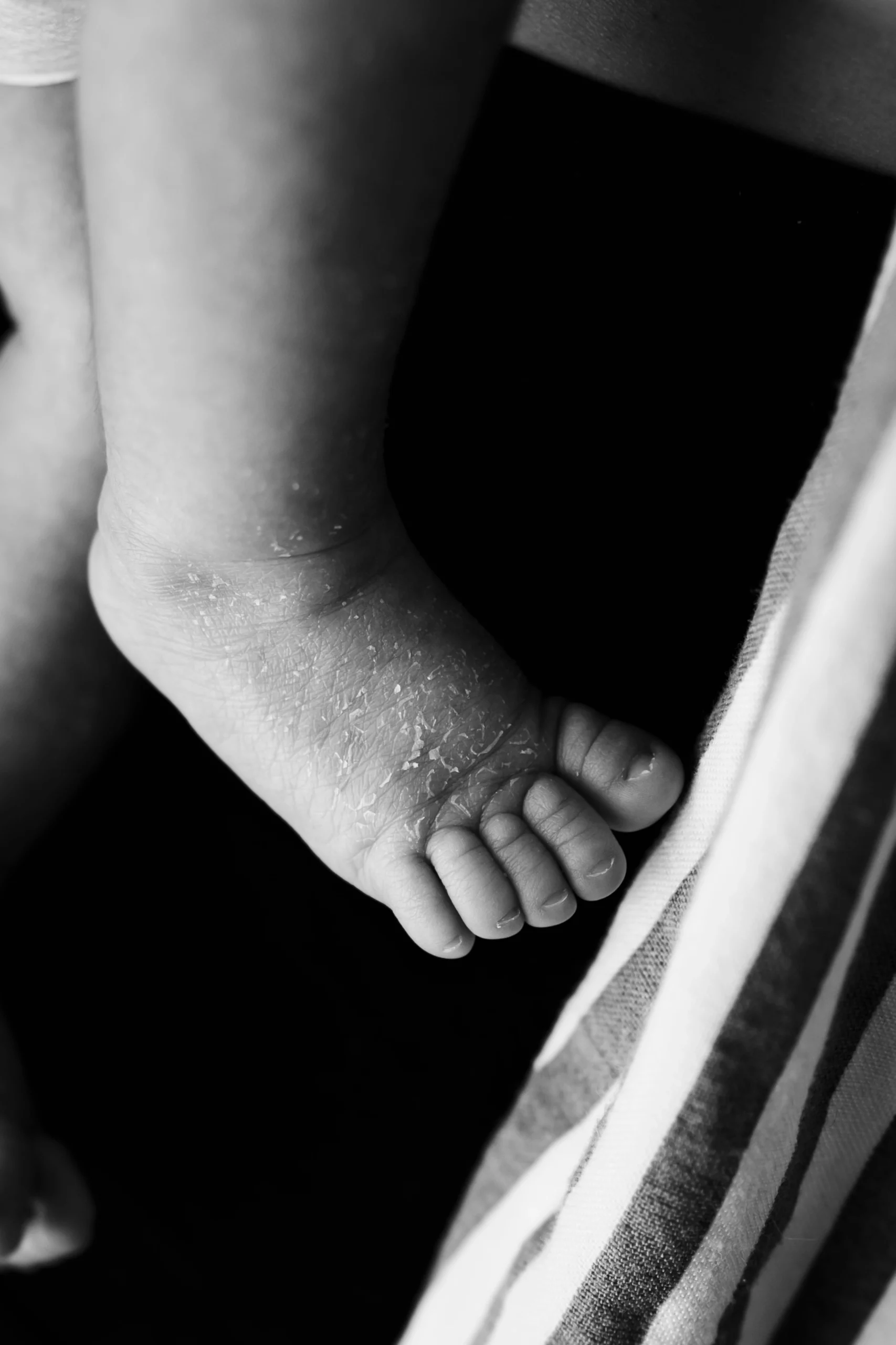 Détail en noir et blanc d'un pied de nouveau-né avec la peau qui pêle pendant une séance photo de naissance à domicile à Fontainebleau